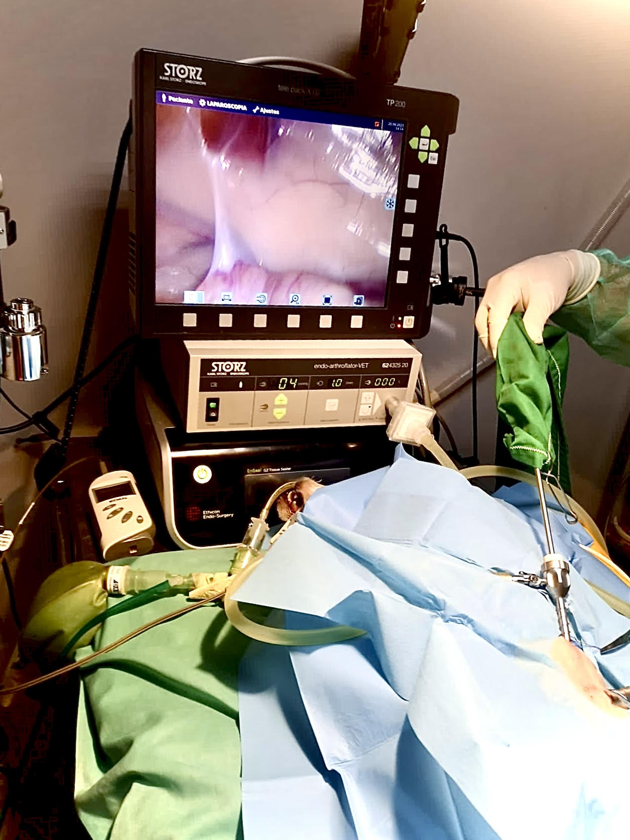 laparoscopia 1